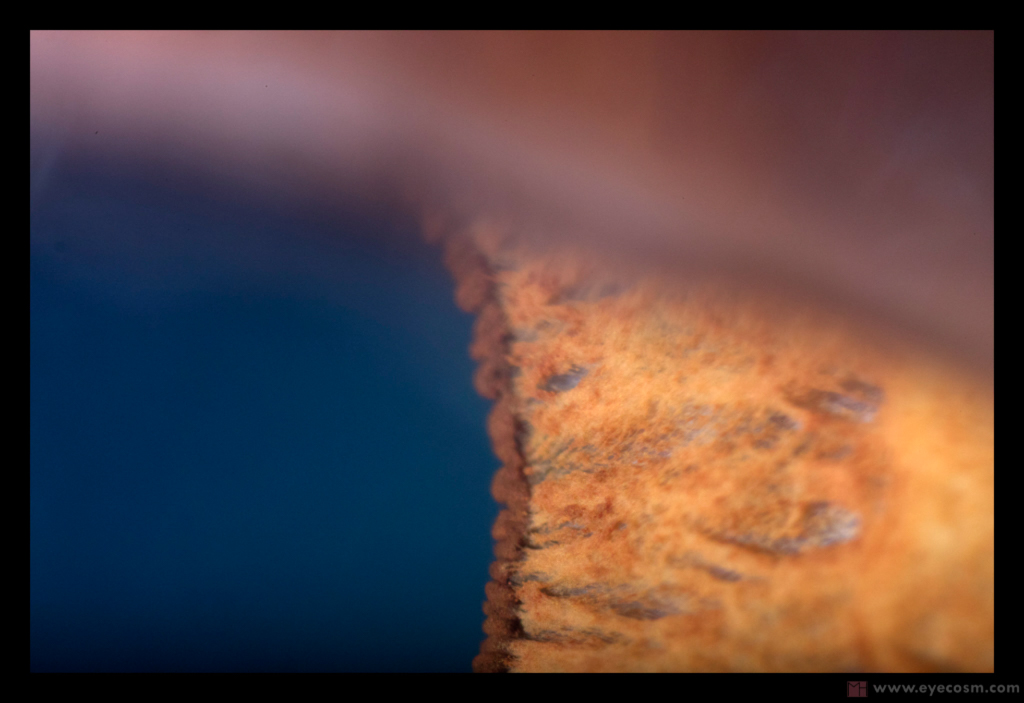 IN_A_BLINK_OF_AN_EYE  iris photography macro